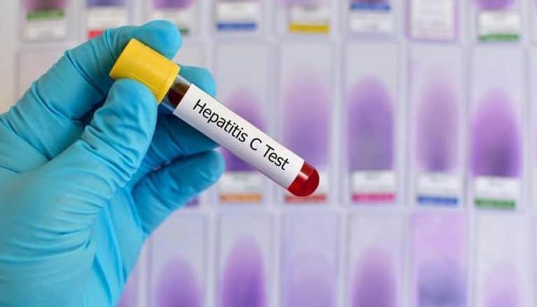 التهاب الكبد “سي”.. 5 حالات تجعلك عرضة للإصابة